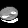 SPORK, NICO - 22.03.1976 - 02.08.2022 - CT obere Extremität - 17:56:57